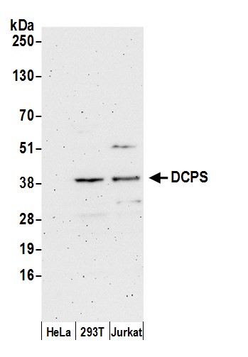 Detection of human DCPS by western blot.