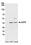 Detection of human DCPS by western blot.