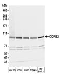 Detection of mouse COPB2 by western blot.
