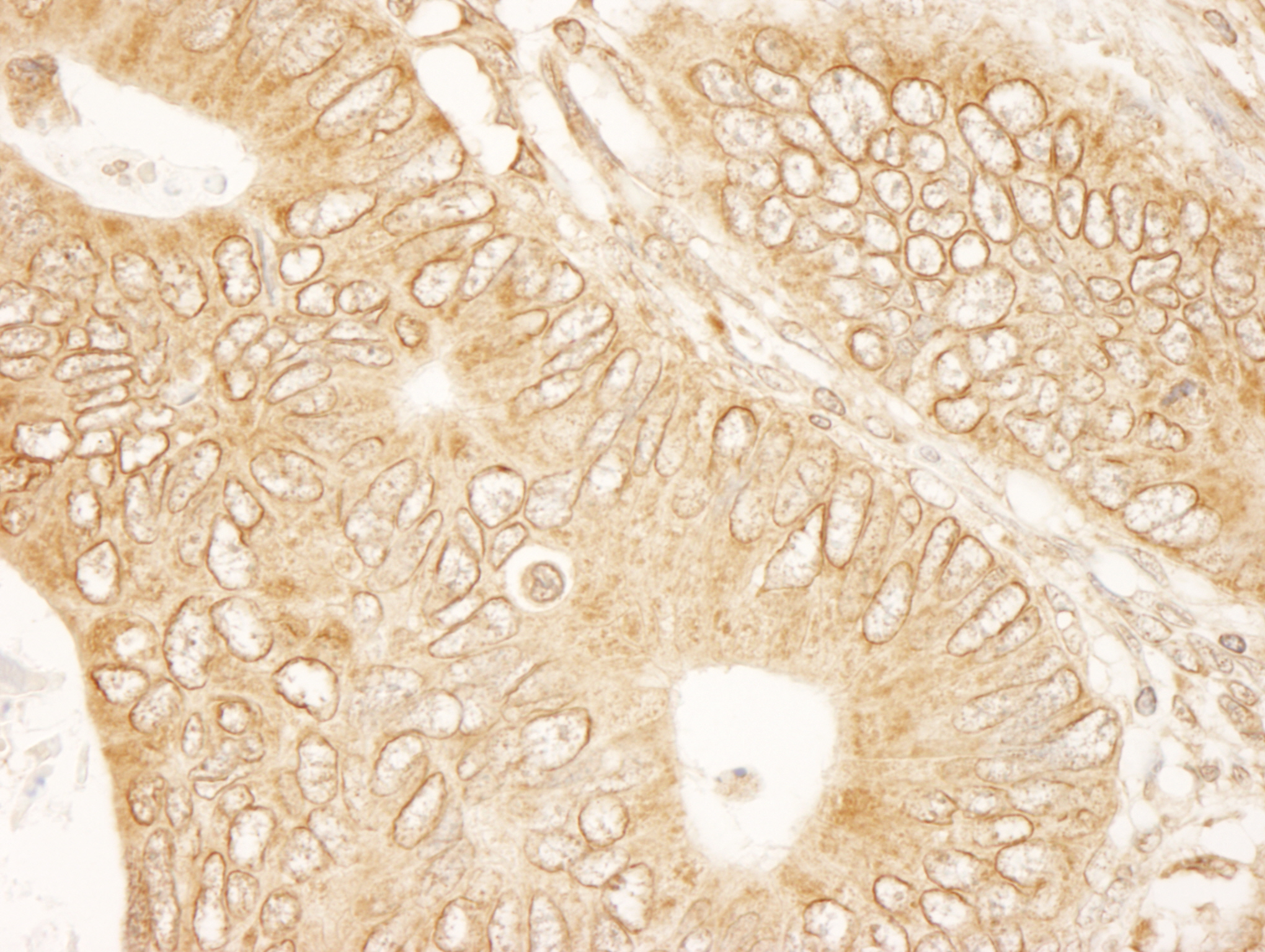 Rabbit anti-RanGAP1 IHC Antibody