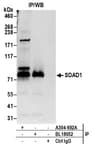 Detection of human SDAD1 by western blot of immunoprecipitates.