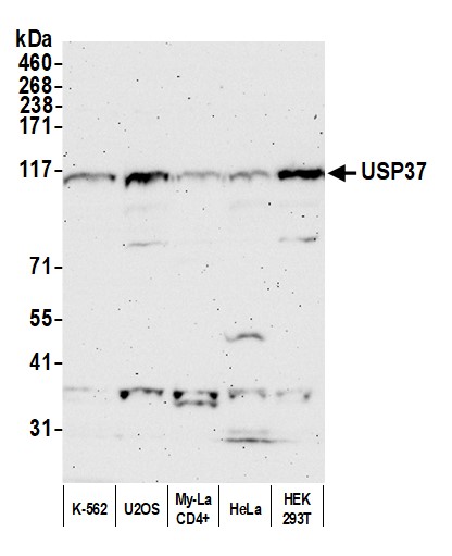 Detection of human USP37 by western blot.