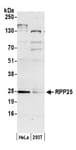 Detection of human RPP25 by western blot.