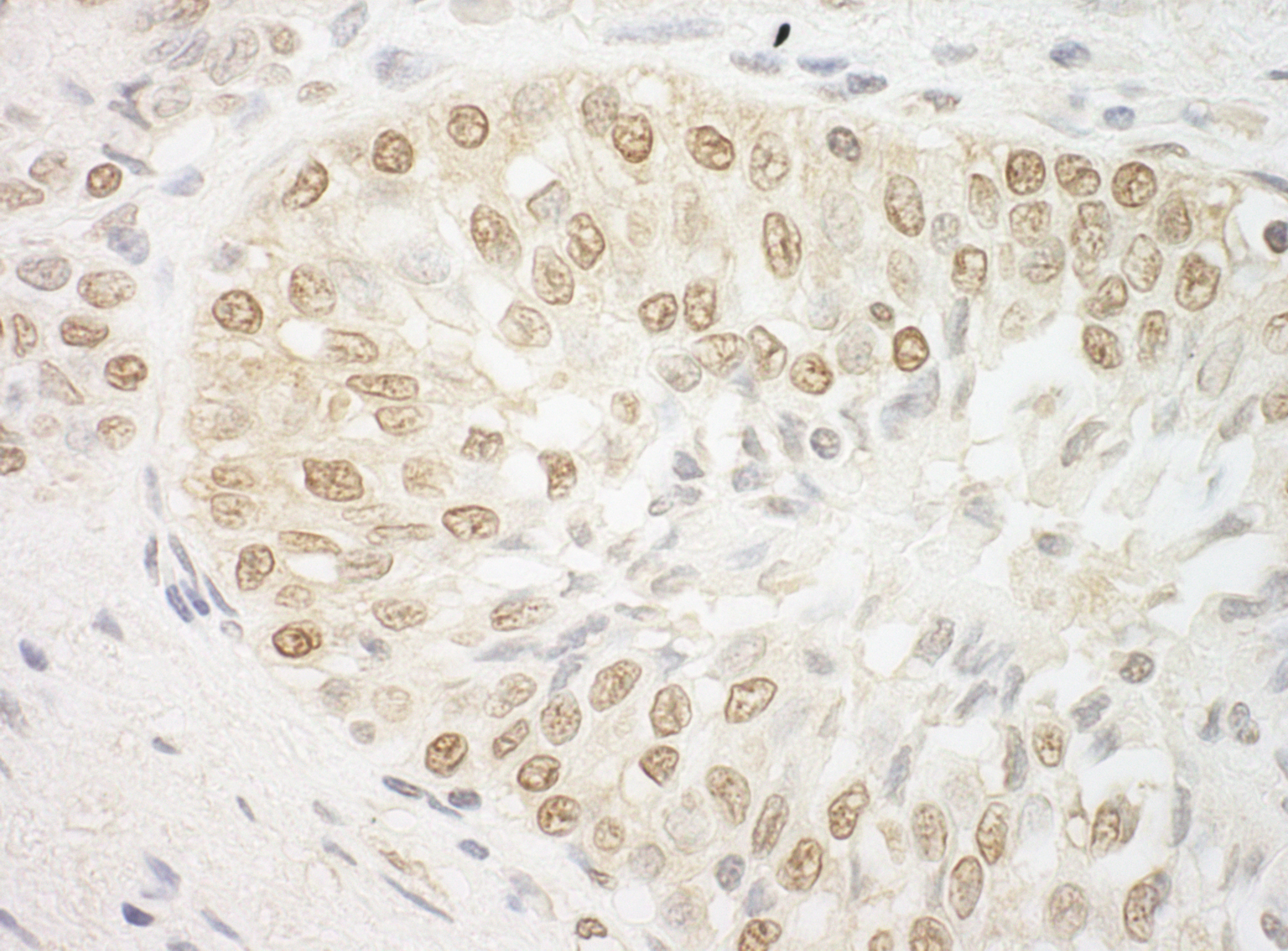 Rabbit anti-ARID3B IHC Antibody