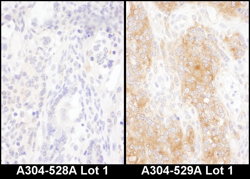 Detection of mouse DYNC1I2 by immunohistochemistry.
