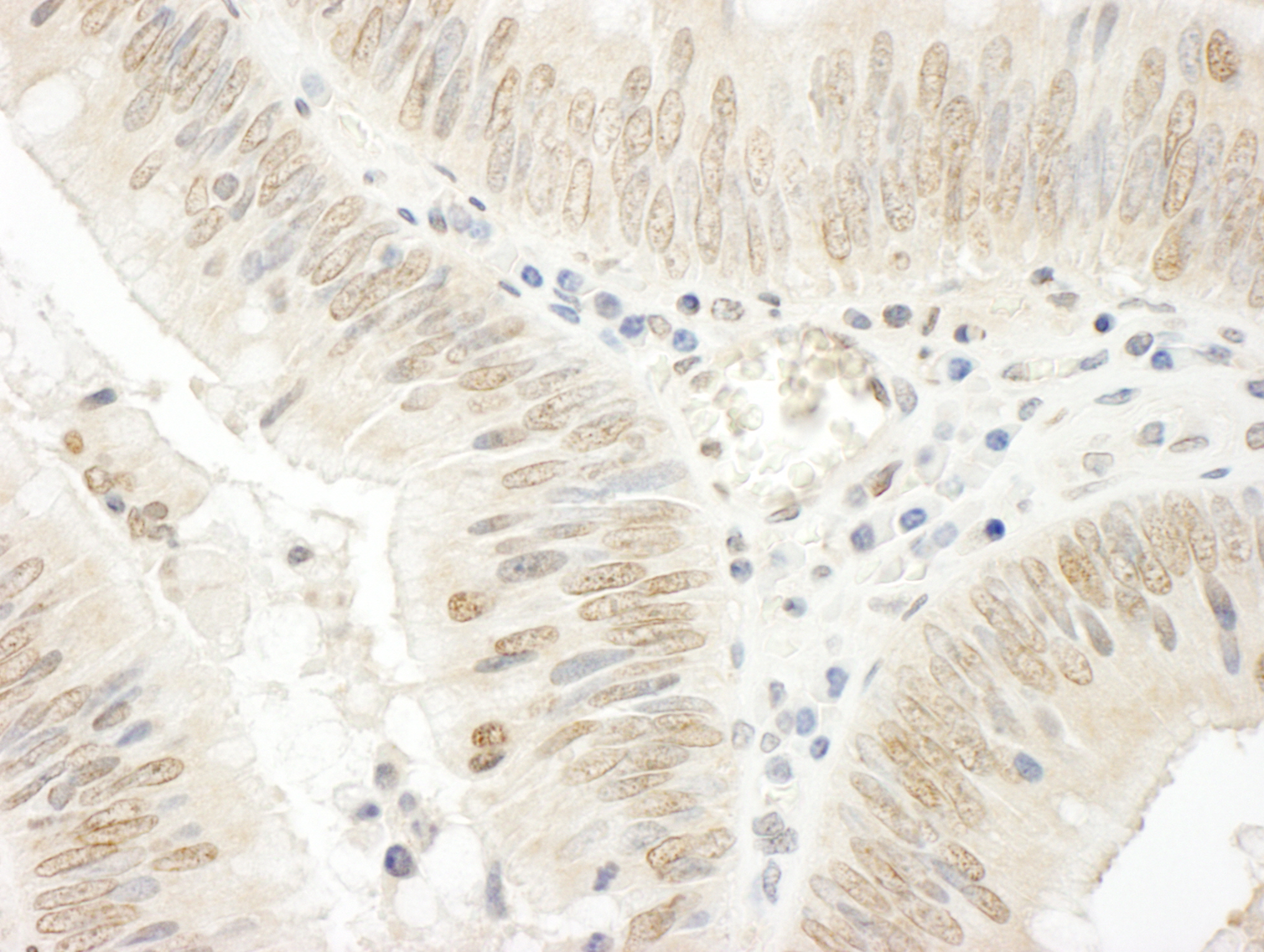 Rabbit anti-NOPP140 IHC Antibody