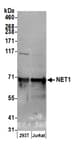 Detection of human NET1 by western blot.