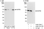 Detection of human NOP56 by western blot and immunoprecipitation.