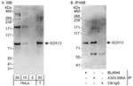 Detection of human SOX13 by western blot and immunoprecipitation.