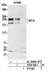 Detection of human NF-H by western blot of immunoprecipitates.