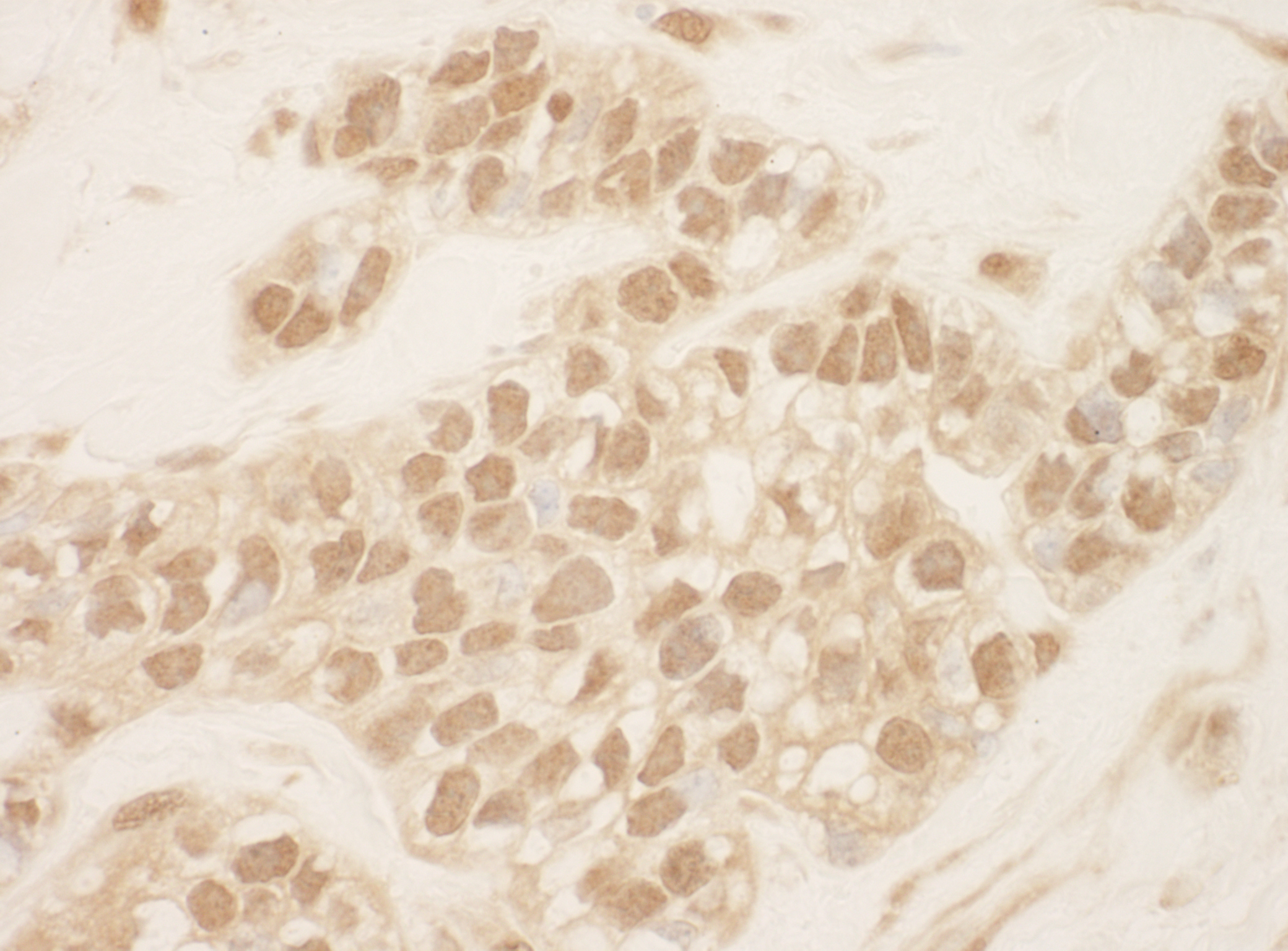 Rabbit anti-Cul2 IHC Antibody