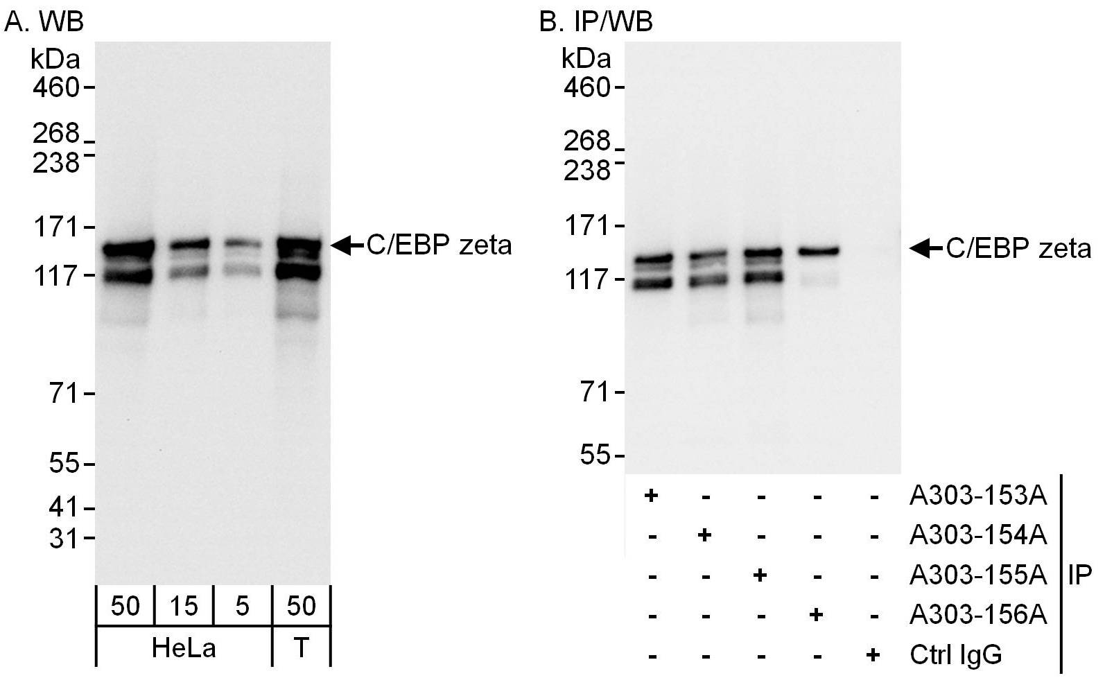 Detection of human C/EBP zeta by western blot and immunoprecipitation.