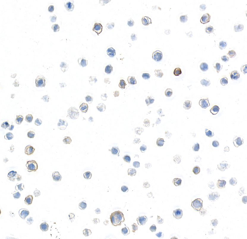 Detection of human P-Selectin/CD62P by immunocytochemistry.