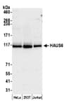 Detection of human HAUS6 by western blot.
