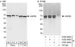 Detection of human and mouse HSP60 by western blot (h&amp;m) and immunoprecipitation (h).