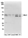 Detection of human and mouse CBLC by western blot.