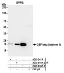 Detection of human CBF-beta (isoform 1) by western blot of immunoprecipitates.