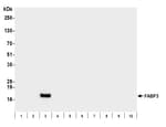 Detection of human FABP3 by western blot.