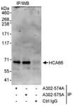 Detection of human HCA66 by western blot of immunoprecipitates.