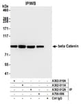 Detection of human beta Catenin by western blot of immunoprecipitates.