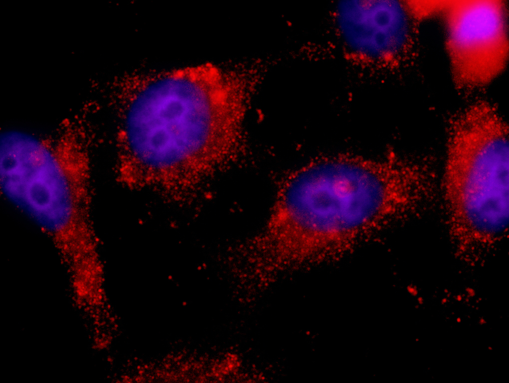 Rabbit anti-ILK IHC Antibody