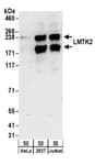 Detection of human LMTK2 by western blot.