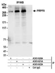 Detection of human PRPF8 by western blot of immunoprecipitates.