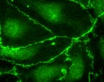 Detection of FLAG™-tagged Beta-Catenin by immunofluorescence.