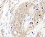 Detection of mouse CCT3 by immunohistochemistry.