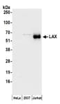 Detection of human LAX by western blot.