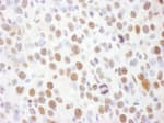 Detection of mouse Phospho Rad17 (S645) by immunohistochemistry.