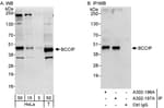 Detection of human BCCIP by western blot and immunoprecipitation.