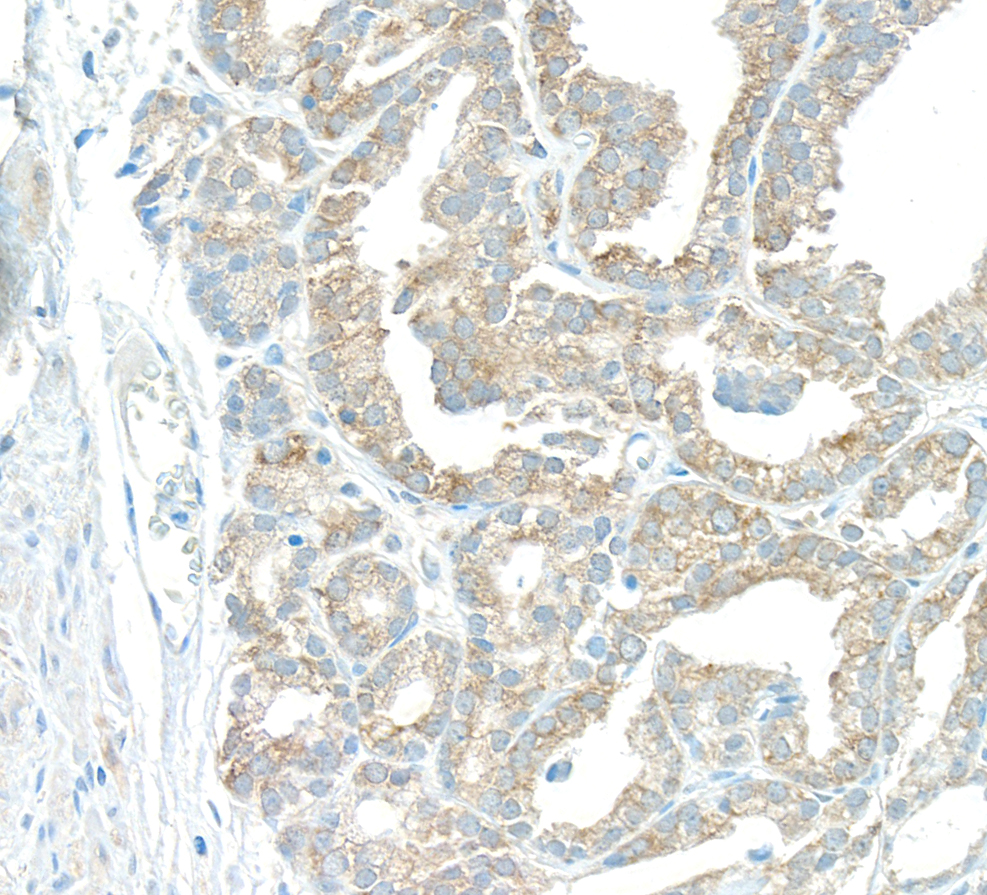 Detection of human EBP1 by immunohistochemistry.