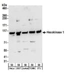 Detection of human and mouse Hexokinase 1 by western blot.