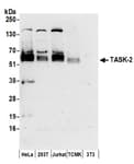 Detection of human and mouse TASK-2 by western blot.