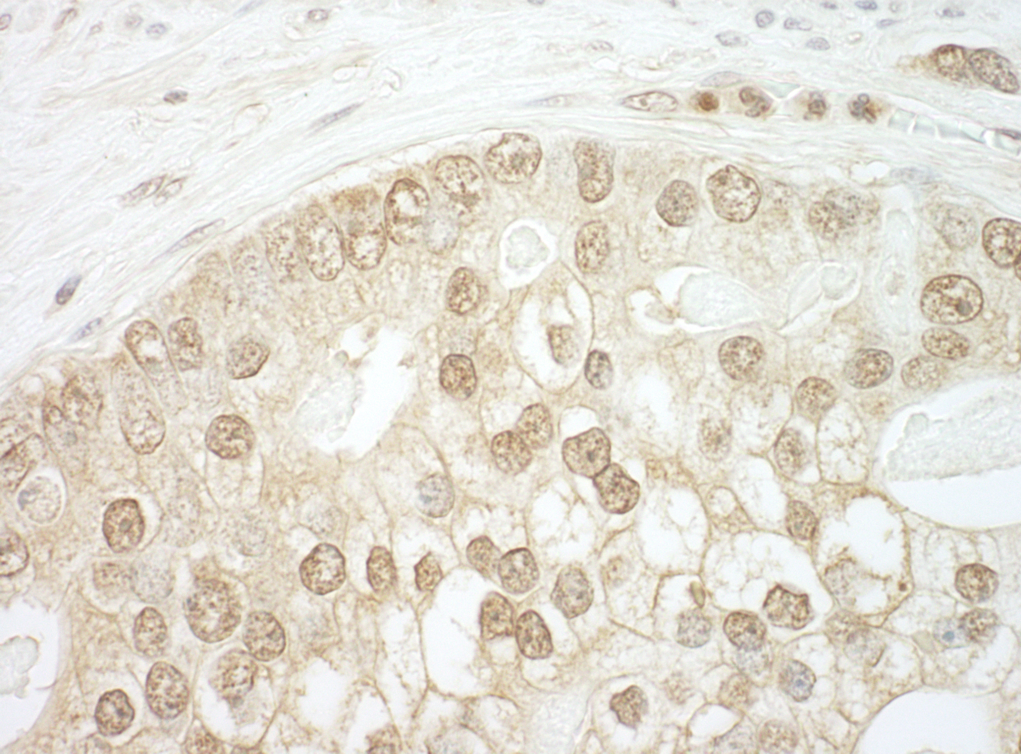 Detection of human CNOT2 by immunohistochemistry.