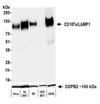 Detection of human CD107a/LAMP1 by western blot.