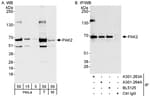 Detection of human and mouse PAK2 by western blot (h&amp;m) and immunoprecipitation (h).