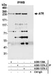 Detection of human ATR by western blot of immunoprecipitates.