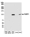Detection of human PARP1 by western blot.
