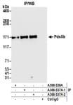 Detection of human Pds5b by western blot of immunoprecipitates.