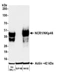 Detection of human NCR1/NKp46 by western blot.