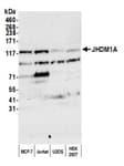 Detection of human JHDM1A by western blot.