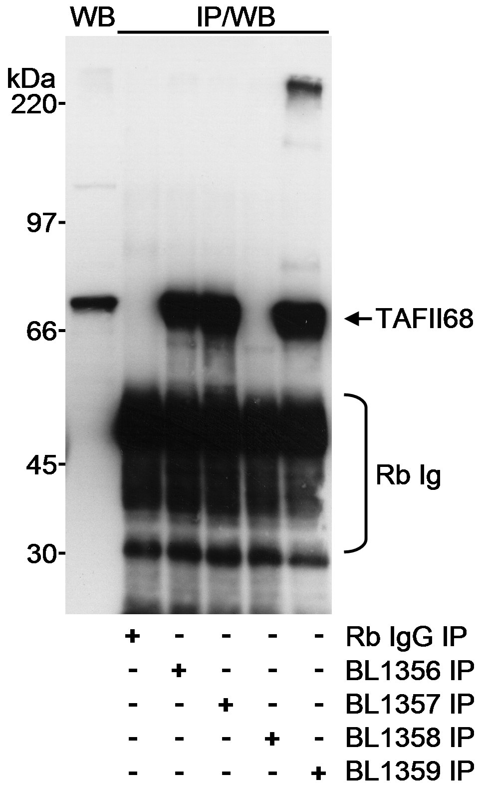 Detection of human TAFII68 by western blot and immunoprecipitation.