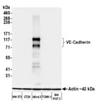 Detection of mouse VE-Cadherin by western blot.