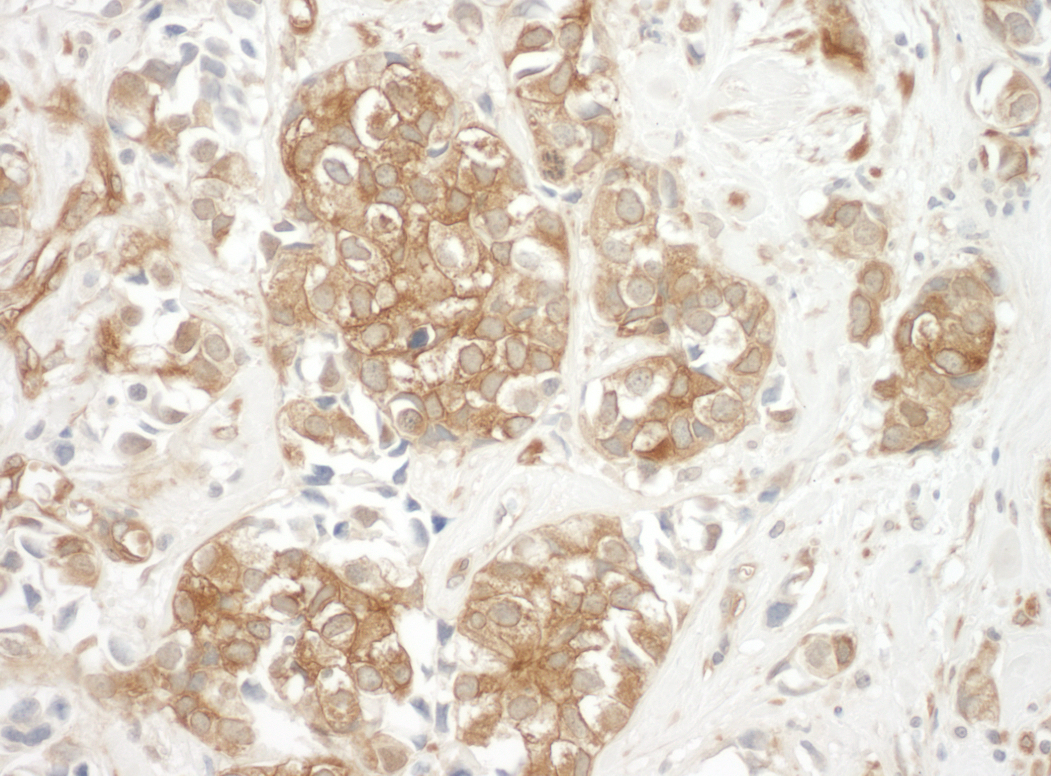 Rabbit anti-Cortactin IHC Antibody