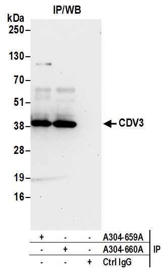 Detection of human CDV3 by western blot of immunoprecipitates.