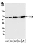 Detection of mouse TFEB by western blot.