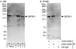 Detection of human ZBTB11 by western blot and immunoprecipitation.