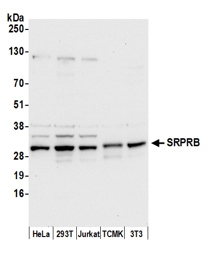 Detection of human and mouse SRPRB by western blot.